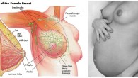 Breast care is an important part of pregnancy since breasts will grow and may lose their shape and firmness. It may ensure better and smooth milk flow for breastfeeding and […]
